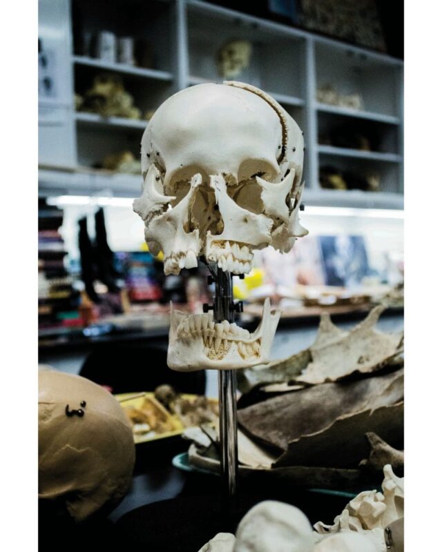 複数の骨で出来ている頭蓋骨