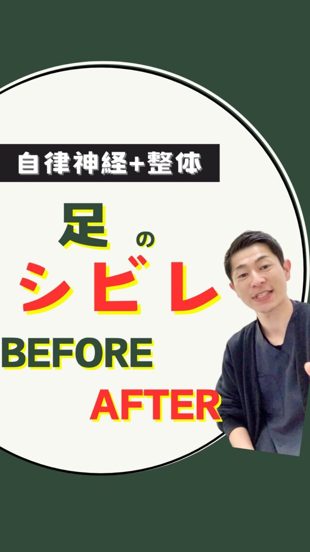 今回は「足のシビレ」でお困りのビフォーアフターです！

・スムーズに歩けない
・走れない
・立っているにも大変、、

このような場合、神経伝達に問題があるかもしれません！

施術は、、

・とてもソフト
・全く力が入っていない
・触れるという感覚の施術

以上のような印象を持たれる方が多くいらっしゃいます。

「整体やマッサージの強い刺激が苦手、、」

そんなあなたでも安心して受けていただけるでしょう。

じつは自律神経を活性化させるためには力は必要ありません！

「たまプラーザ整体かんだや」は自律神経の乱れを感じているあなたへ
役立つ情報を発信しています！

『役に立った！』
『もっと知りたい！』

などなどあれば
「コメント・いいね❤️」お願いします！

::::::::::::::::::::::::::::::::::::::::::::::::::::::::::::::::::::::::::::::::::::
【たまプラーザ整体かんだや自律神経専門の整体】
・
◼︎自律神経に特化した施術
・
◼︎東急田園都市線
『たまプラーザ駅北口徒歩３分』
・
◼︎完全個室のプライベート空間
・
◼︎30,000人以上の施術実績
・
◼︎住所
神奈川県横浜市青葉区美しが丘5丁目2ー14
たまセンター第2ビル
HALレンタルスペースＣルーム
・
【ご予約・お問い合わせは】
☎️045-479-1021
👇ホームページ👇
https://kandaya1.com
《LINE予約》24時間受付中
::::::::::::::::::::::::::::::::::::::::::::::::::::::::::::::::::::::::::::::
#自律神経整体
#自律神経失調症
#自律神経改善
#自律神経の乱れ
#自律神経バランス
#たまプラーザ整体